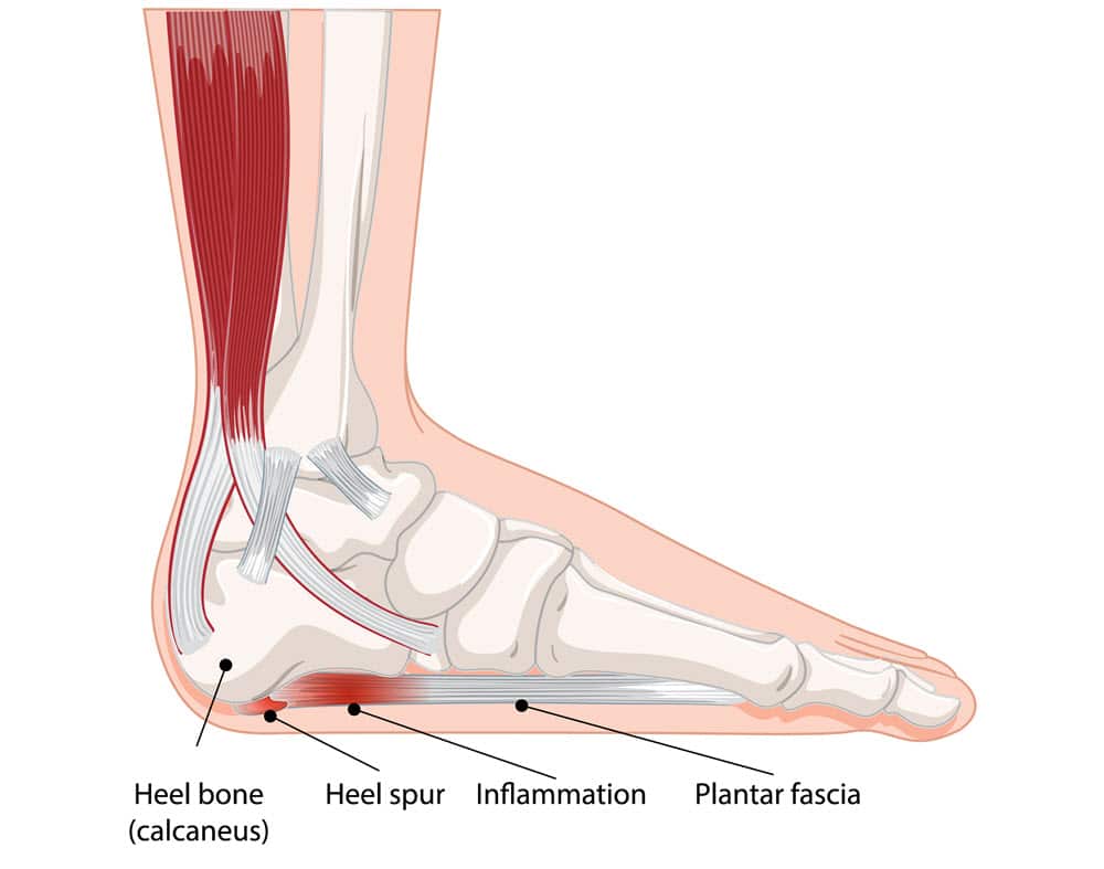 causes of foot pain