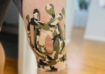 therapy for knee pain