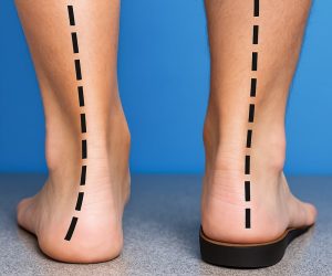 Custom Made Foot Insoles